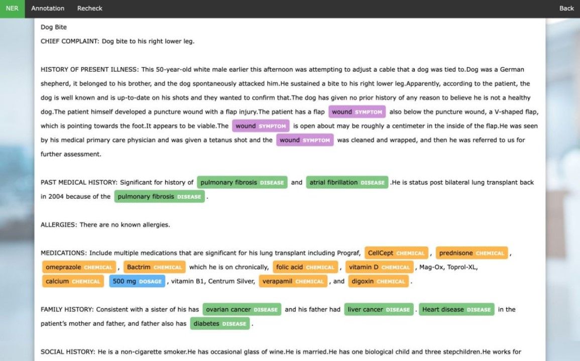 Document Annotation is a Game-Changer in Text Processing