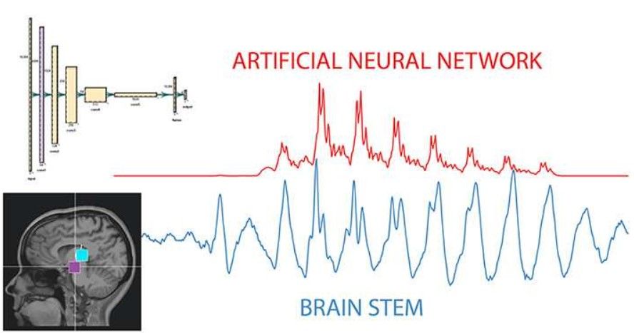 'Raw' data shows AI signals mimic brain activity