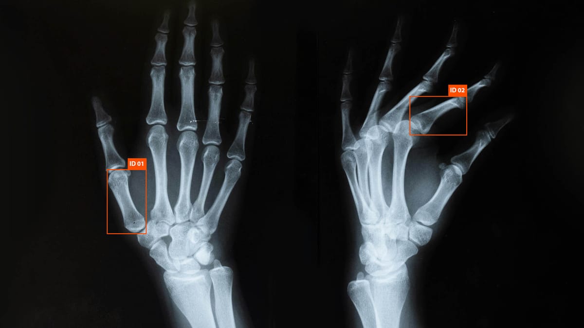 X-Ray Annotation: Detecting Threats and Objects in Security Scans